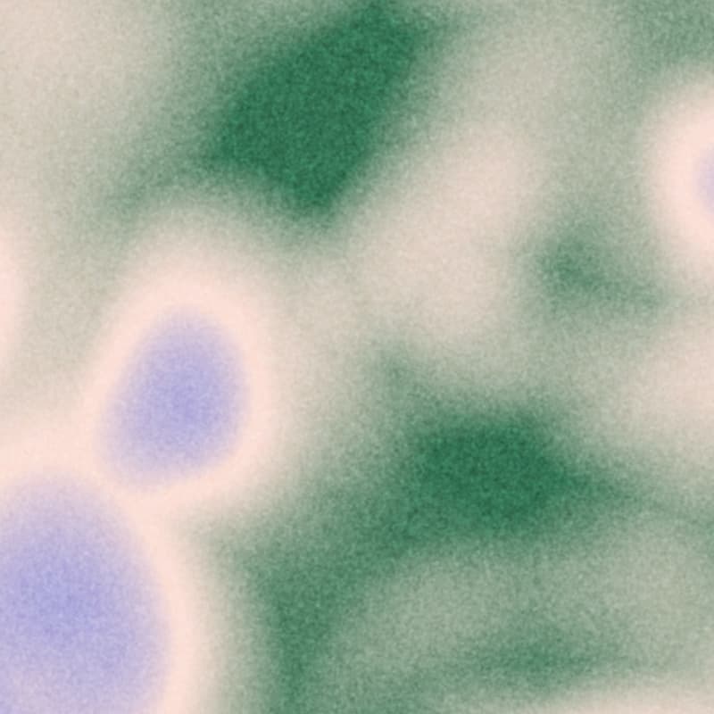 https://greenspacehealth.com/en-ca/wp-content/uploads/sites/3/2022/09/GS_MRI-Texture_Primary-Green_Still-1.jpg